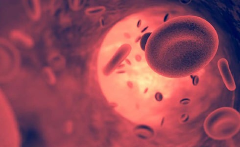 sDMHemocromatosis17.jpg sDMHemocromatosis17.jpg